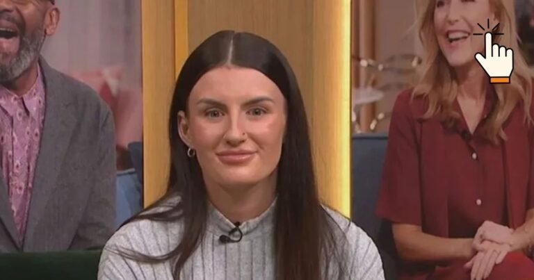 This woman is allergic to water, the body starts burning as soon as it touches, the truth of the rare disease will be done!