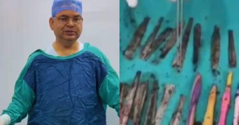 Haapur News: 28 teaspoons, 19 toothbrush and two pens… What did it come out of the young man’s stomach in Hapur! Doctors also lost their senses