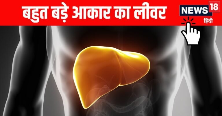 Due to excessive drinking, the woman was admitted to the hospital, the doctors examined, then they were conscious after seeing the size of the liver!
