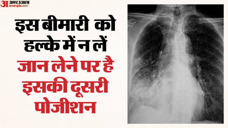 Increasing danger: Most people are dying from this disease after heart attacks in Delhi, children are more victims – Pneumonia Is Second Leading Cause Of Death In Delhi After Heart Attacks