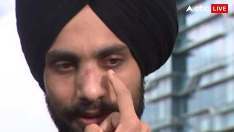 ‘Indian dog, go back…’, racial attack on Indian in Australia, 3 people broke nose of Sikh youth