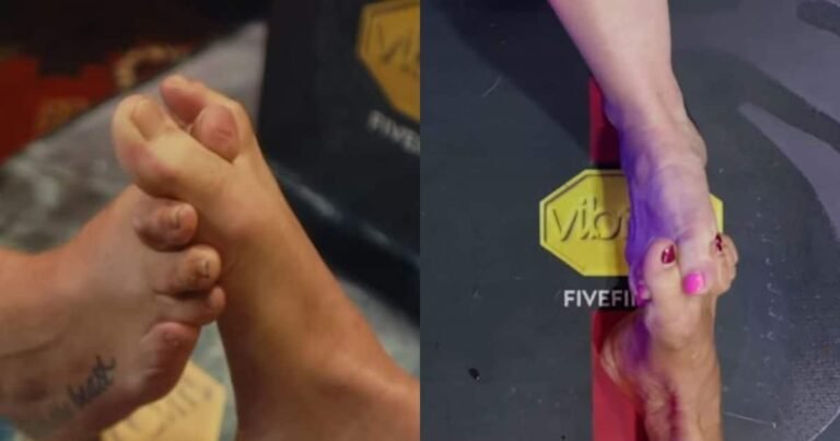 Toe Wrestling: Wrestling is done with the toe, the history is years old, where does this sport take place?