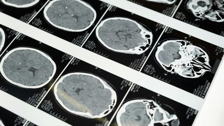 China develops ultrasound brain-computer interface without surgery