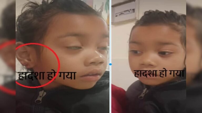 Daughter wore gold earrings, thieves cut off her ears, the girl got drenched in blood