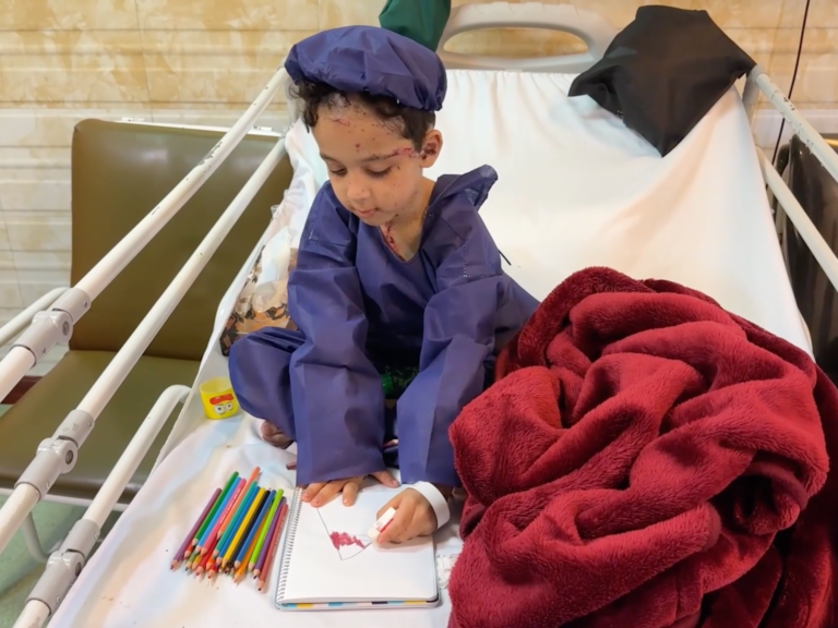 Children wounded in the US-Israeli strikes receive treatment in Tehran | US-Israel war on Iran