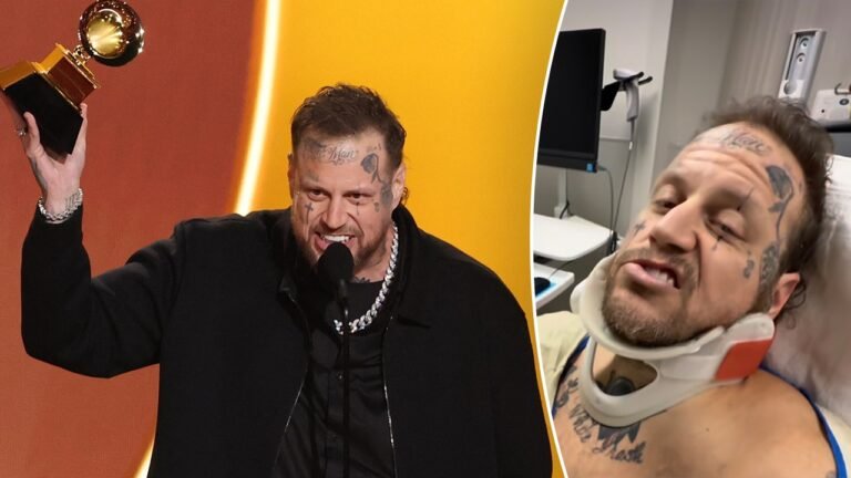 Jelly Roll attended 2026 Grammy Awards with ‘secret’ broken collarbone