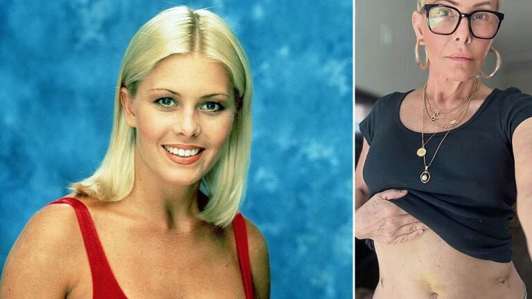 ‘Baywatch’ star Nicole Eggert reveals new cancer signs, gets hysterectomy