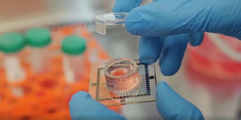 Inside datacenter where day starts with cerebrospinal fluid • The Register