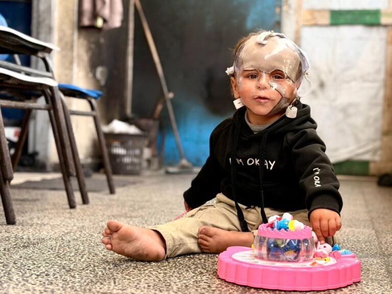 Born during Israel’s genocide: Gaza’s child survivors bear the scars of war | Israel-Palestine conflict