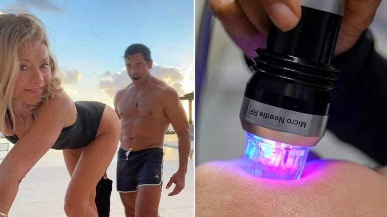 Kelly Ripa’s butt microneedling procedure explained by a dermatologist