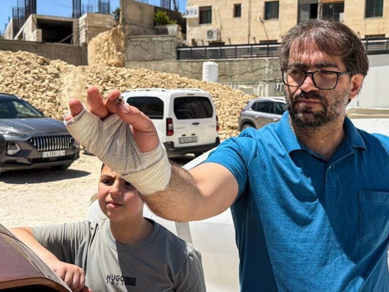 ‘Lives turned in a second’: Family of baby Sam, shot dead by Israel, grieve | Israel-Palestine conflict News